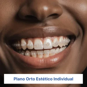 Plano Orto Estético